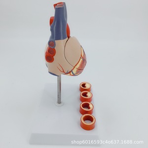 Stent cardiaque, bypass des artères coronaires, chirurgie ouverte de la valve cardiaque, thrombose humaine, démonstration de la structure cardiaque et vasculaire - Product Image 1
