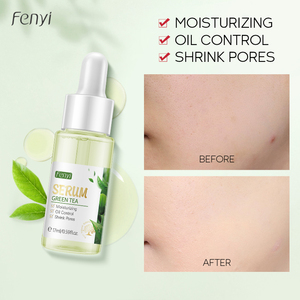 Fenyi 17ml Sérum Facial Anti-Acné au Thé Vert pour Contrôle du Sébum, Réduction des Pores et Réparation Cutanée à la Glycérine - Product Image 3