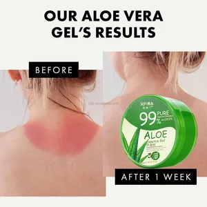 Özel etiket 300ml organik yüz toptan özelleştirilmiş akne kaldırma jel 100% saf doğal yatıştırıcı Aloe Vera jel