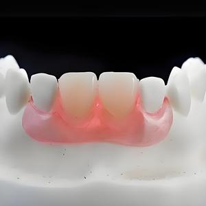 Prothèse dentaire durable en résine, base rose, prothèses amovibles flexibles, impression 3D dentaire, base flexible - Product Image 3