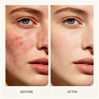 Crème hydratante apaisante et réparatrice au collagène, à l'arnica et au calendula, pour le visage, marque privée, produits de soin coréens