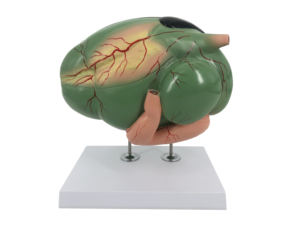 Gelsonlab HSBM-523 MODEL ginjal kanan dan kiri - Product Image 3