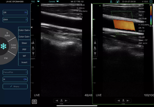 Konted MDR عناصر دوبلر بالموجات فوق الصوتية اللاسلكية المحمولة اللون C10CX المستخدمة للكشف عن الكلى والقلب وغيرها - Product Image 5
