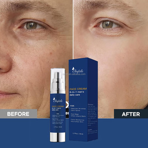 Hidratante facial 6 en 1 para <span class=keywords><strong>hombre</strong></span>, Retinol orgánico Natural, crema antiarrugas antienvejecimiento, humectante blanqueador para el cuidado <span class=keywords><strong>de</strong></span> la piel <span class=keywords><strong>de</strong></span> la cara y los <span class=keywords><strong>ojos</strong></span> - Product Image 4