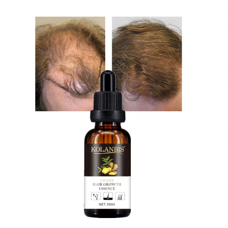 Fast Grow Hair Oil 30ml Ginger Extract Hair Tonic For Anti Hair Loss