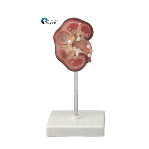 Modèle pédagogique de calcul rénal pour l'enseignement en urologie - Product Image 1