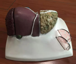 Ciência médica modelo de anatomia do fígado, vasos sanguíneos do fígado, modelo estrutural da bexiga biliar - Product Image 2