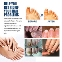 Formule végétale OEM 30ml traitement soulageant les ongles gris soulagement apaisant ongles bio rapide huile d'arbre à thé anti-démangeaisons gris ongle pied spray