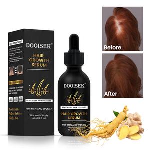 Suero para el cabello Tratamiento reparador para el cuidado del cuero cabelludo Tratamiento antipérdida de cabello Nuevo aceite esencial orgánico para el crecimiento del cabello para mujeres y hombres - Product Image 4