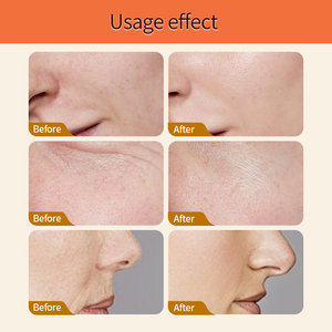 Sérum pour le visage éclaircissant à la vitamine C, logo personnalisé, biologique, puissant antioxydant, réduit les taches brunes, éclaircit le teint - Product Image 6