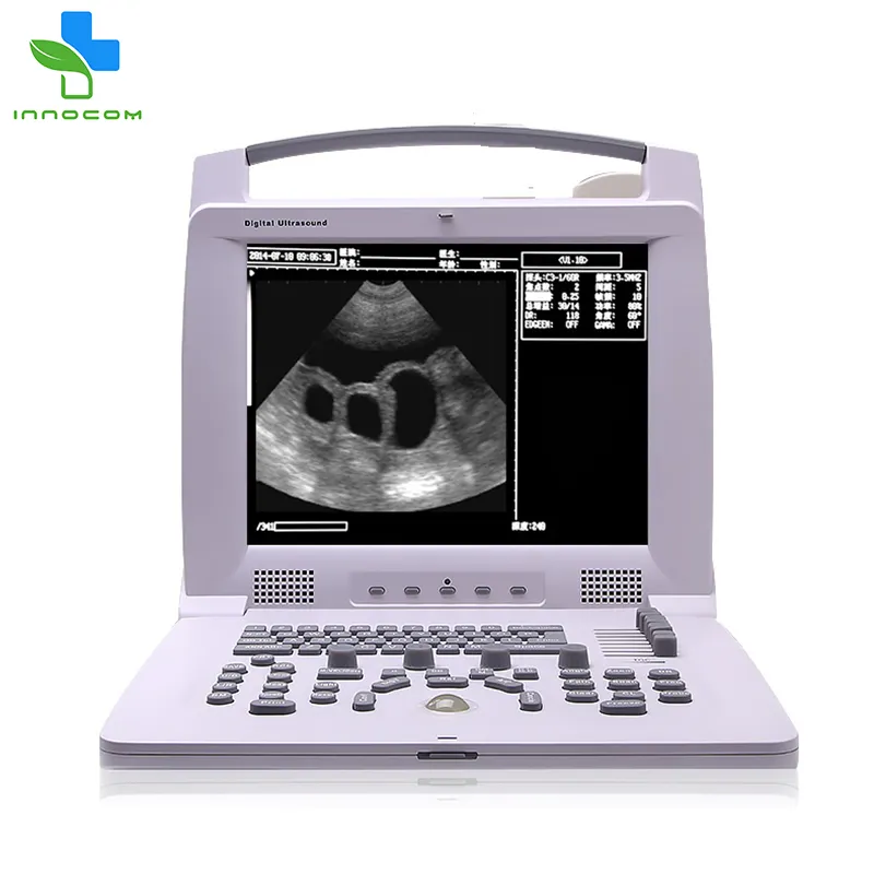 Prezzo della macchina dell'analizzatore di ultrasuono dell'attrezzatura veterinaria dell'analizzatore di ultrasuono portatile veterinario