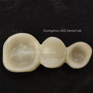 Prothèse dentaire de laboratoire dentaire Couronnes et ponts en zircone Livraison rapide et à bas prix - Product Image 6