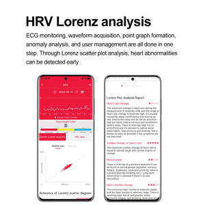 Spevan ET593モントル接続アクティビティフィットネストラッカー男性防水ECGスマートウォッチAndroid IOS電話用 - Product Image 3