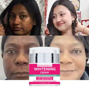 7일 미백 페이스 크림, 4% 알부틴 보습 미백 잡티 개선제, 최고의 페이스 미백 로션 - Product Image 1