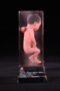 Modèle d'embryon imprimé en 3D d'embryons malformés Apprentissage de l'<span class=keywords><strong>embryologie</strong></span> pour l'éducation médicale - Product Image 3