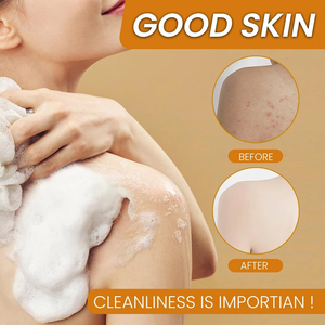 Nghệ & hạt chanh thanh cơ thể xà phòng axit tartaric chà cho khách sạn loại bỏ đốm đen cho làn da nhạy cảm Axit Kojic Đen - Product Image 2