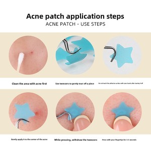 Cerotti per Acne a Forma di Stella e <span class=keywords><strong>Cuore</strong></span>, Ultra-sottili e Invisibili, Adesivi Decorativi per il Viso, Patch per Brufoli - Product Image 4