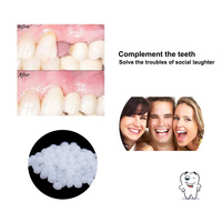 4 couleurs Nouvelle restauration dentaire Faux dents Réparation de dents Perfect Smile Facettes Comfort Fit Flex Dentiers Bretelles Adhésifs Colle