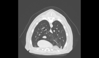 EURVET Équipement vétérinaire stable, scanner de tomodensitométrie spiralée, équipement d'imagerie CT pour hôpital vétérinaire