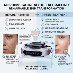 <span class=keywords><strong>Pistola</strong></span> de <span class=keywords><strong>Mesoterapia</strong></span> <span class=keywords><strong>Automática</strong></span> <span class=keywords><strong>para</strong></span> Inyección Facial Multi-Needle, Hidratante Dérmica con Colágeno, Sin Agujas, Oxígeno Jet Hidratante - Product Image 3