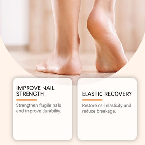 Spray para el Cuidado y Nutrición de las Uñas de los Pies, 20 ml, Alta Calidad, Bajo Precio, Éxito de Ventas, Blanco, Portátil - Product Image 4
