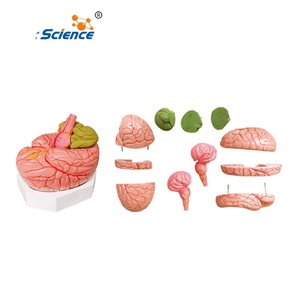 脳動脈解剖模型 - Product Image 1