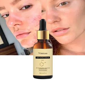 Skin Care Vegan Herbal Private Label Facial Tea Tree Salicylic Acid Essence Skin Face Anti Acne Remover Treatment Serum