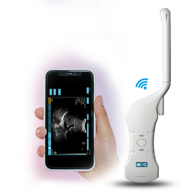 Stock Handheld Portable Gynecology Double Wireless Probe Linear Ultrasound Probe