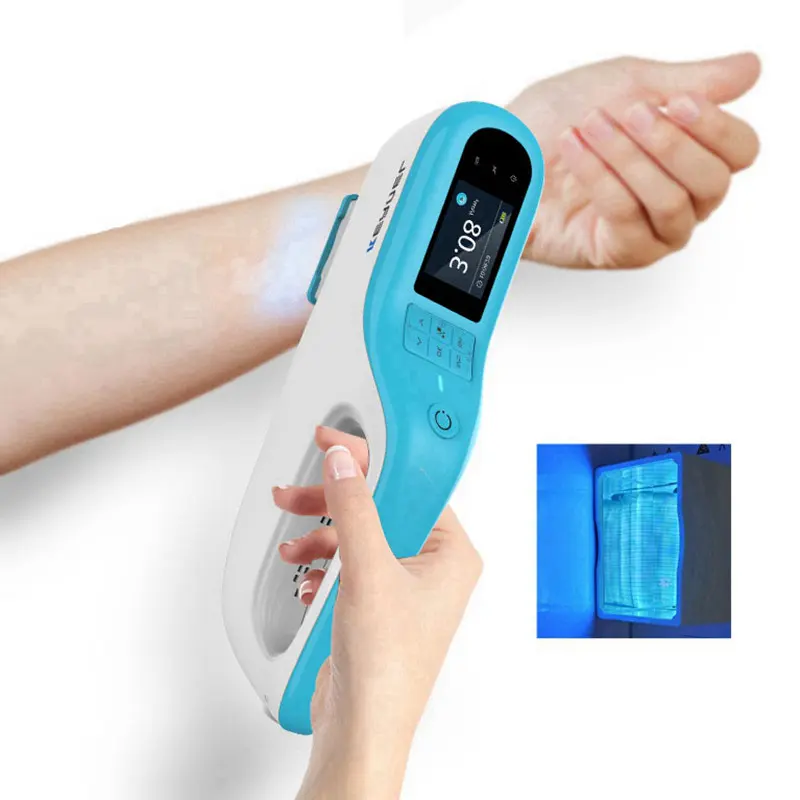 Portable Vitiligo UV Phototherapy Lamp Kernel KN-5000E excimer 308nm led uvb psoriasis vitiligo laser