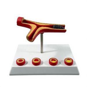 Modèle de blocage des vaisseaux sanguins en anatomie humaine LYA-002, concentration sanguine, <span class=keywords><strong>pathologie</strong></span> des graisses, atherosclérose, <span class=keywords><strong>pathologie</strong></span> <span class=keywords><strong>vasculaire</strong></span> - Product Image 6