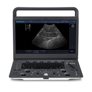 Ecógrafo Portátil Sonoscape E1 en Blanco y Negro con Pantalla de 15.6 Pulgadas para Diagnóstico - Product Image 3