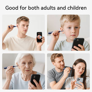 Herramienta Eléctrica para Remover Cerumen S1 Pro, Limpiador de <span class=keywords><strong>Canal</strong></span> Auditivo con Cámara, Alimentado por USB, para Examen de Oído/Nariz - Product Image 6