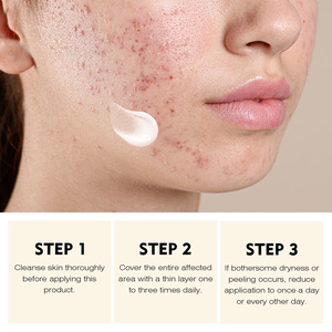 Herbal AHA 100g Crema facial Gel hidratante blanqueador suave para el cuidado de la piel facial Contracción de poros Control de aceite Acné Eliminación de espinillas - Product Image 4