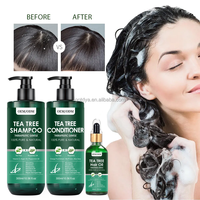 Set de Cuidado Capilar Antifúngico de Marca Privada, Crema para el Cuero Cabelludo, Tratamiento Anticaspa para Cabello Graso y Dermatitis Seborreica, Proveedor al por Mayor