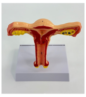 Système reproducteur féminin modèle anatomique utérus et ovaire simulateur d'enseignement gynécologique pour la science médicale