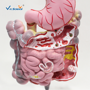 Modelo <span class=keywords><strong>de</strong></span> Simulación <span class=keywords><strong>de</strong></span> Enfermedades del Sistema Digestivo - Modelo Anatómico <span class=keywords><strong>de</strong></span> Ciencias Médicas para Entrenamiento en Escuelas <span class=keywords><strong>de</strong></span> Medicina Vic Science Model - Product Image 1