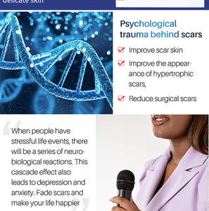 Crema para eliminar <span class=keywords><strong>cicatrices</strong></span> antiguas y manchas oscuras <span class=keywords><strong>en</strong></span> <span class=keywords><strong>las</strong></span> <span class=keywords><strong>piernas</strong></span>, 30g, elimina <span class=keywords><strong>las</strong></span> <span class=keywords><strong>cicatrices</strong></span> postoperatorias, previene eficazmente la proliferación de <span class=keywords><strong>cicatrices</strong></span> después de la cirugía - Product Image 4