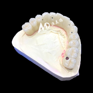 Premium Implantaat-Ondersteunde Prothese | Titanium <span class=keywords><strong>Abutment</strong></span> Met Precisie Zirkonia Kroon Voor Stabiele En Comfortabele Pasvorm - Product Image 3