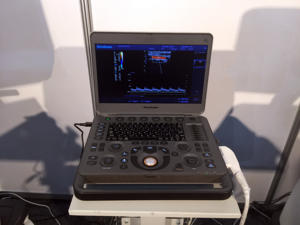 Harga Mesin <span class=keywords><strong>Echocardiography</strong></span> Portabel Sonoscape X3 X5 untuk Penggunaan Manusia/Hewan - Product Image 4
