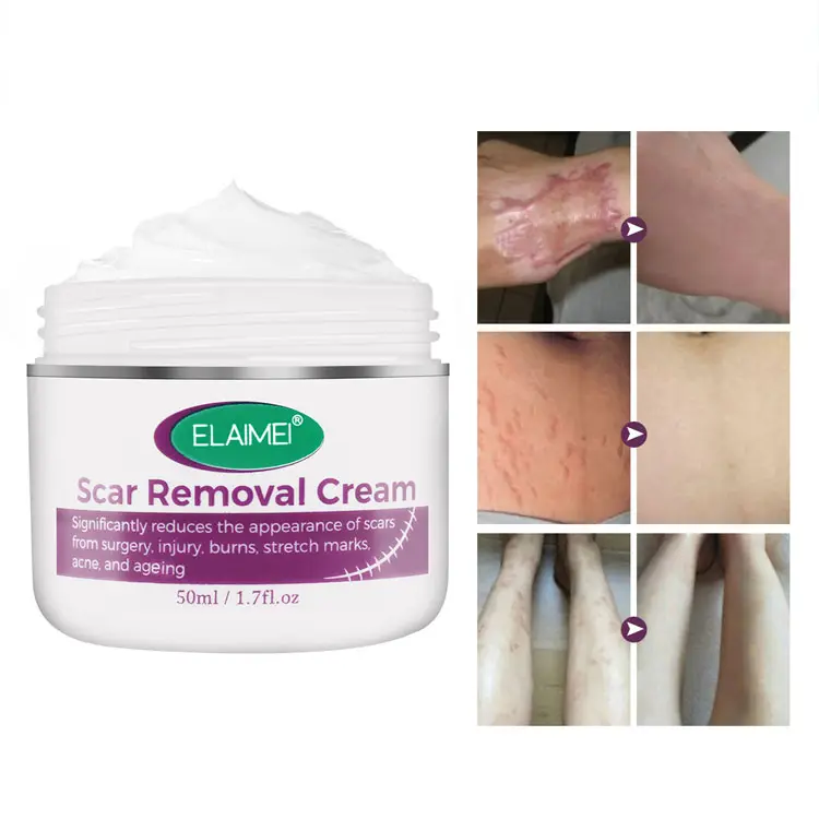 ELAIMEI Skin Care Best Effective Burn Old Scar Removal Cream