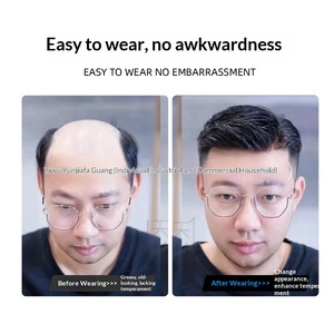 Parrucca <span class=keywords><strong>da</strong></span> <span class=keywords><strong>uomo</strong></span> con <span class=keywords><strong>capelli</strong></span> <span class=keywords><strong>veri</strong></span>, processo a ago completo, blocco frontale in biomembrana invisibile e senza cuciture, può essere permanentata, tinta e pettinata all'indietro - Product Image 3