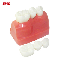 Dentiste dentaire Modèle de Dents De Démonstration D'implant L'analyse Couronne Pont bon