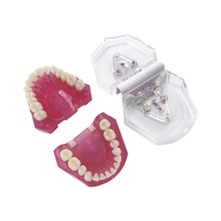 YOUYA DENTAL MX-038 Modèle dentaire en résine, dents amovibles, modèle anatomique pour l'étude et l'enseignement, gingive souple, Typodont