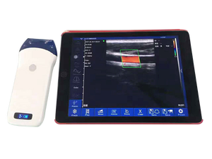 Sonda de Ultrassom Portátil Sem Fio com Array Linear, Imagem Colorida Doppler, Grau Clínico - Product Image 6