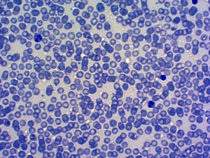 Set di 15 Preparati Microscopici di Celle Ematiche Umane per Citologia <span class=keywords><strong>Standard</strong></span>, per l'Insegnamento nelle Scuole Medie - Product Image 2