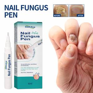 SOUTH MOON Venta al por mayor 5ML Herbal Nail Fungus Treatment Pen Anti Fungal Nail Foot Hongus Remove Gel Nail Repair Tratamiento líquido - Product Image 2