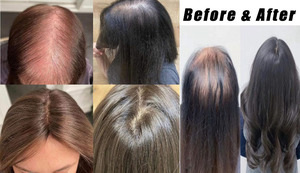 Extensiones de cabello rubio 100% Remy de cabello humano real para mujeres, extensiones de cabello con cabello humano 100% real. - Product Image 6