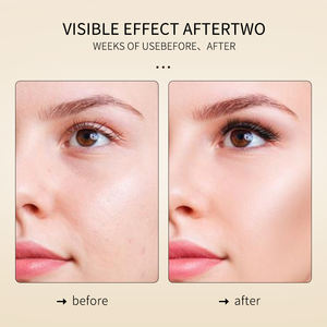 Set de Cuidado de la Piel Krone Personalizado con Suero Hidratante, Humectante e Iluminador de Extracto Natural de Raíz de Peonía, Ácido Hialurónico y Niacinamida - Product Image 5