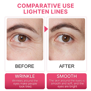 Mascarillas de Silicona Reutilizables con Diseño Personalizado, Antiarrugas, Hidratantes, Transparentes, para Debajo de los <span class=keywords><strong>Ojos</strong></span>, con Textura Suave - Product Image 6