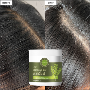 <span class=keywords><strong>Shampoo</strong></span> Antiforfora 2-in-1 con Etichetta Privata, Trattamento per la Cura del Cuoio Capelluto, Scrub Esfoliante Detox al Rosmarino e Menta Piperita - Product Image 3